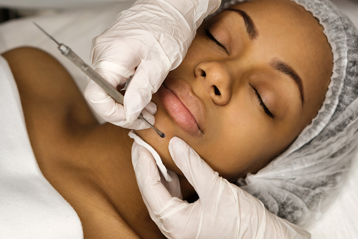 facials